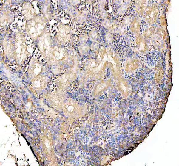 aza2bha3 ckma b primary antibodies ihc testing 3