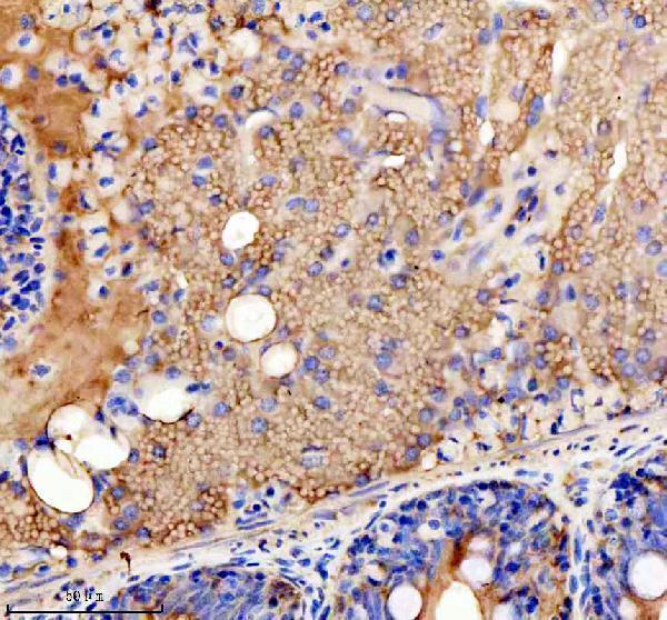 aza2bha3 ckma b primary antibodies ihc testing 4