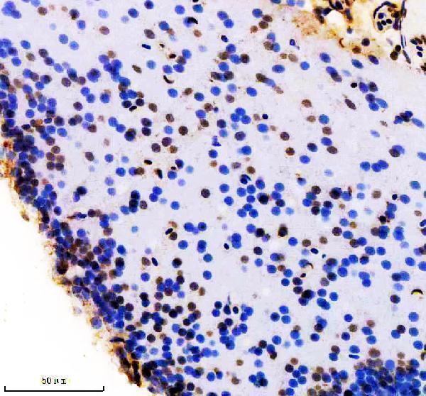 aza2ce80 foxd1 primary antibodies ihc testing 1