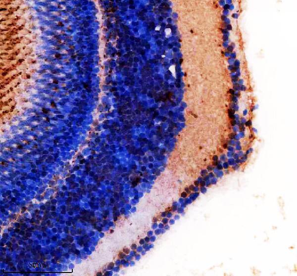 aza2ce80 foxd1 primary antibodies ihc testing 2