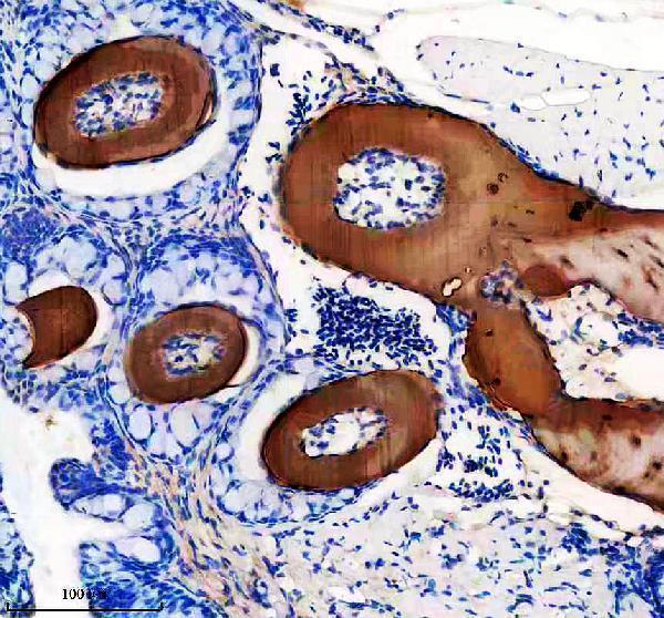 aza2rqr3 col10a1a primary antibodies ihc testing 1