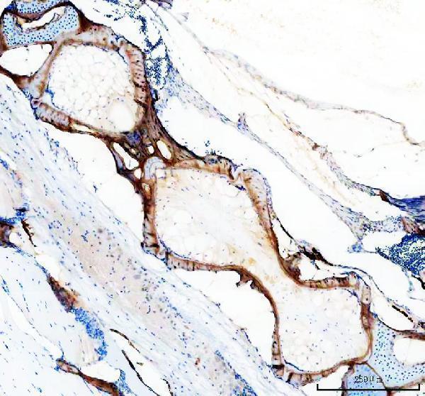 aza2rqr3 col10a1a primary antibodies ihc testing 2