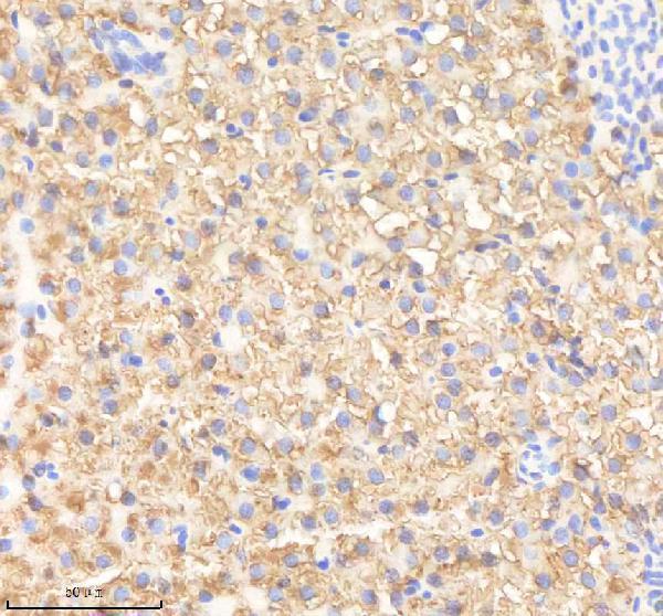 IHC analysis of PRDX4 using anti-PRDX4 antibody (AZA3KP44)