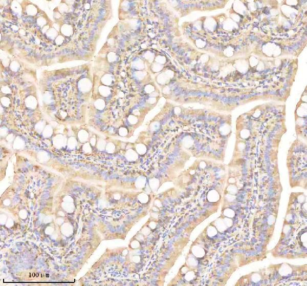 IHC analysis of PRDX4 using anti-PRDX4 antibody (AZA3KP44)