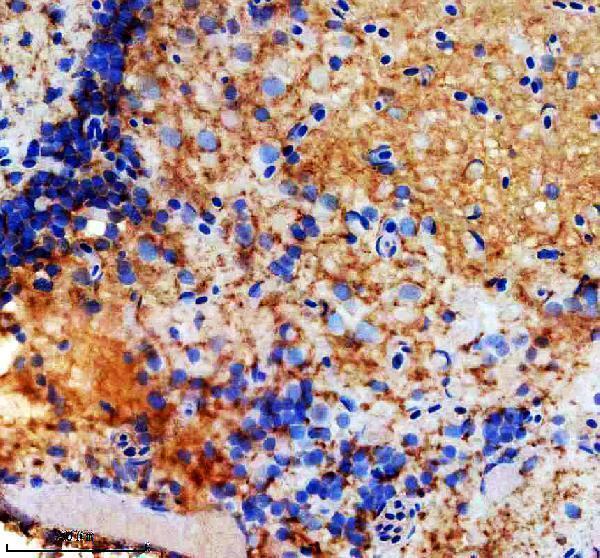 aza3qjz0 gnrhr4 primary antibodies ihc testing 1