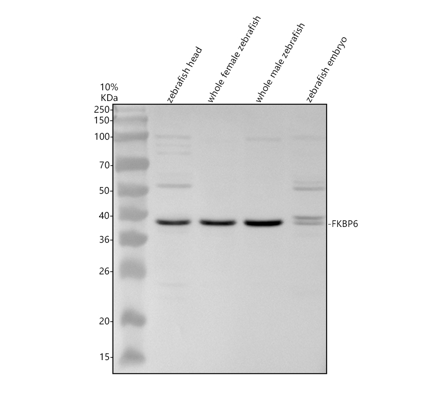 Western blot analysis of FKBP6 using anti-FKBP6 antibody (AZA3QK11)