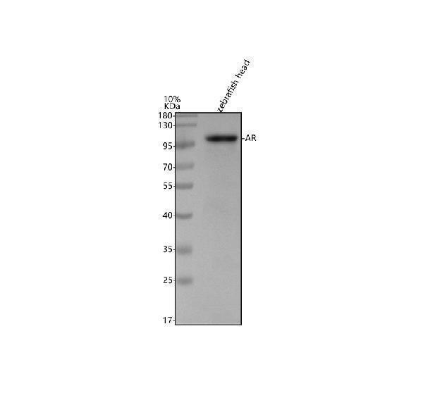  Western blot analysis of Androgen receptor/AR using anti-Androgen receptor/AR antibody (AZA4GT83)