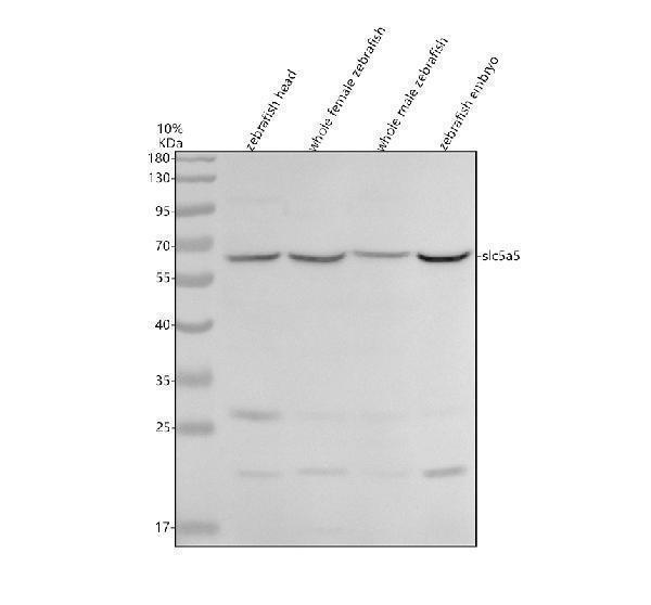 Western blot analysis of SLC5A5 using anti-SLC5A5 antibody (AZA4IG60)