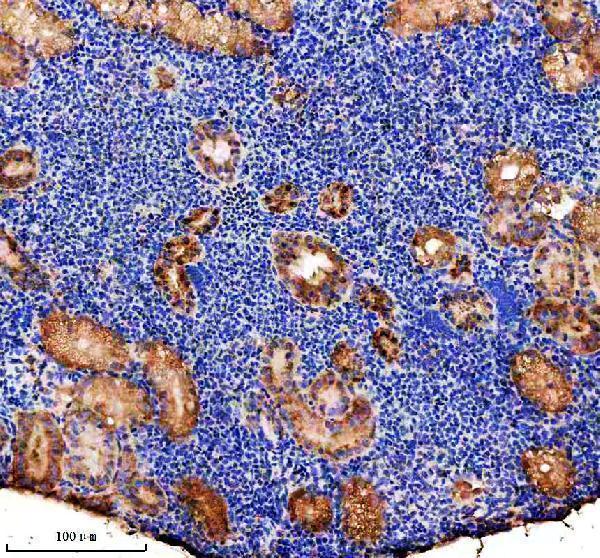  IHC analysis of P5CS/ALDH18A1 using anti-P5CS/ALDH18A1 antibody (AZA4IGC8)