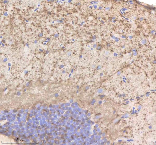 aza4qnw7 phyhipl b primary antibodies ihc testing 1