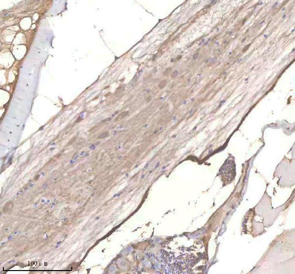aza4qnw7 phyhipl b primary antibodies ihc testing 2