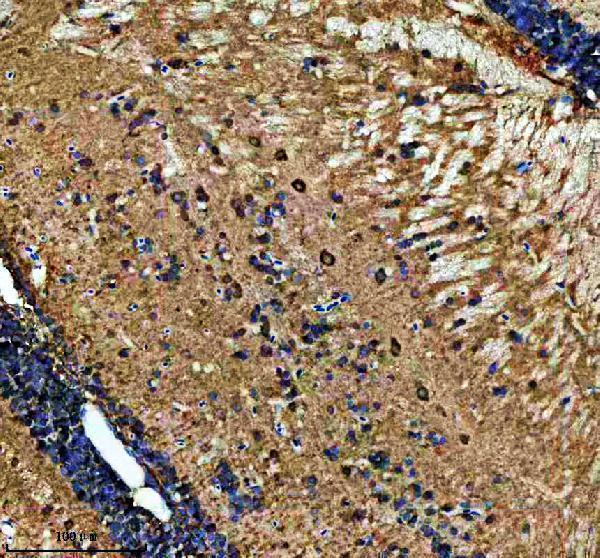 aza5wvx8 metap2a b primary antibodies ihc testing 2