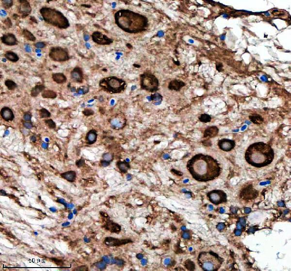 aza5wvx8 metap2a b primary antibodies ihc testing 3