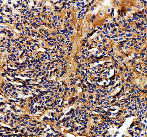 aza5wvx8 metap2a b primary antibodies ihc testing 4