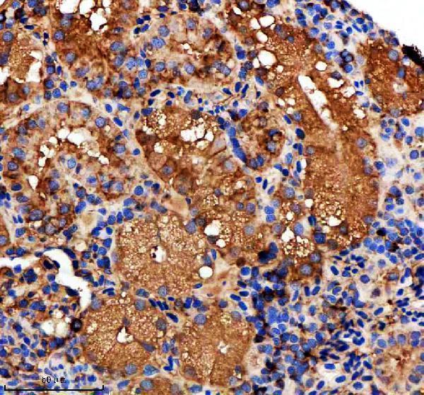 aza5wvx8 metap2a b primary antibodies ihc testing 6
