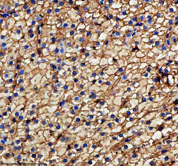 aza5wvx8 metap2a b primary antibodies ihc testing 7