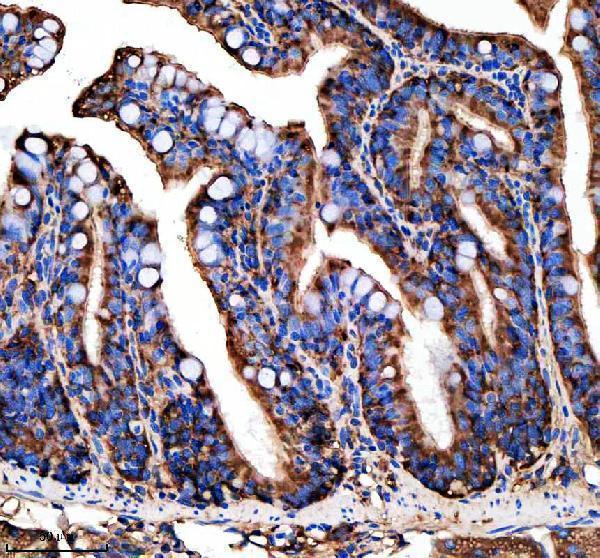 aza5wvx8 metap2a b primary antibodies ihc testing 8