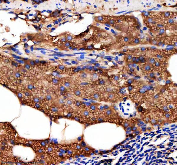 aza5wvx8 metap2a b primary antibodies ihc testing 9