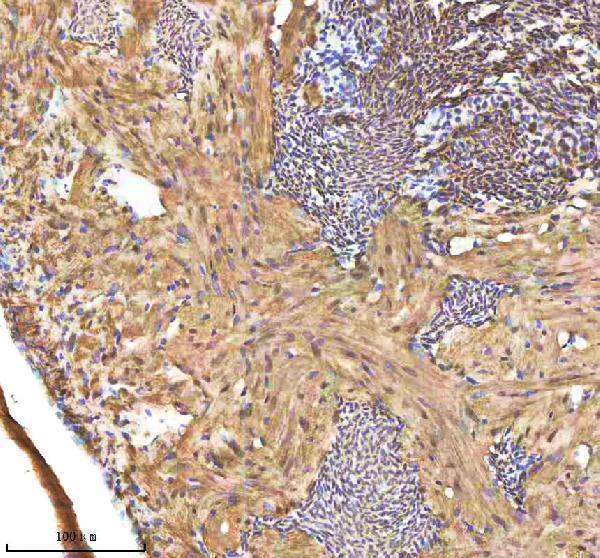  IHC analysis of SREBF1 using anti-SREBF1 antibody (AZA6XLD8)
