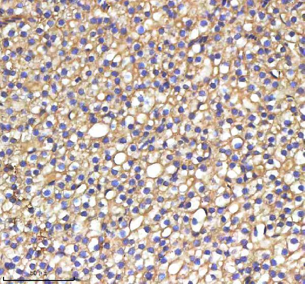  IHC analysis of SREBF1 using anti-SREBF1 antibody (AZA6XLD8)