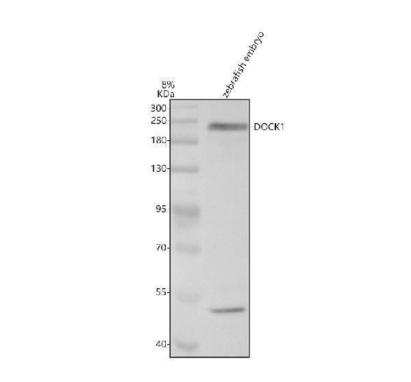 Western blot analysis of DOCK1 using anti-DOCK1 antibody (AZA8E1V6)