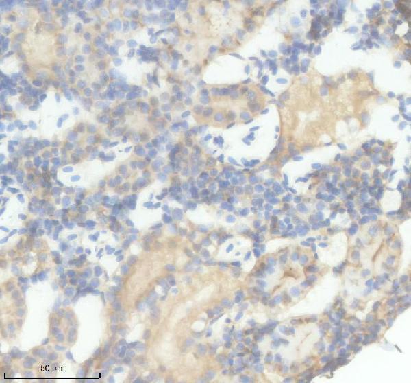 aza8e6e3 ifnphi3 primary antibodies ihc testing 1