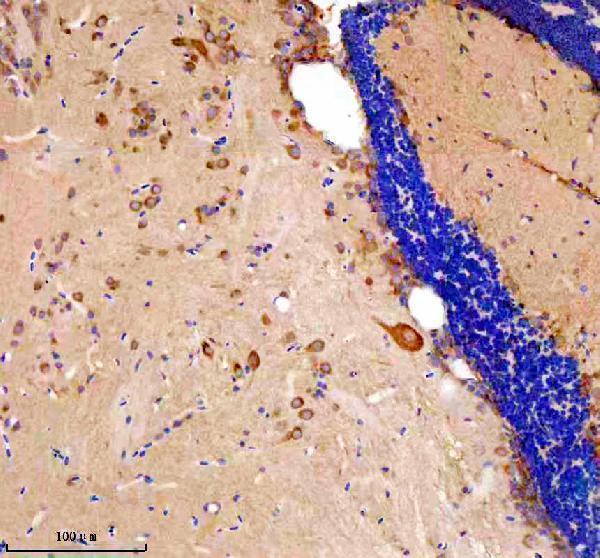 aza8kb65 etf1a b primary antibodies ihc testing 2