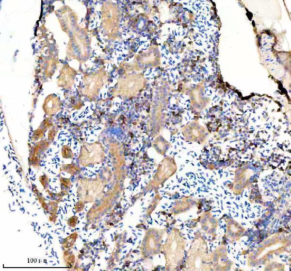 aza8kb65 etf1a b primary antibodies ihc testing 3