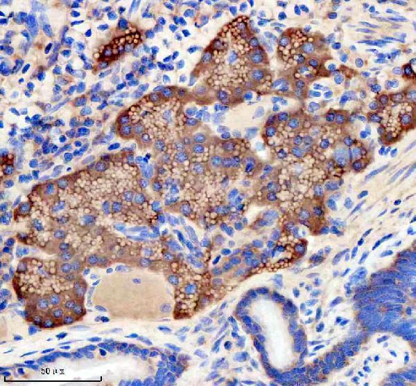 aza8kb65 etf1a b primary antibodies ihc testing 4