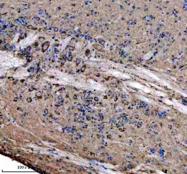  IHC analysis of ATPB/ATP5F1B using anti-ATPB/ATP5F1B antibody (AZA8WGC6)