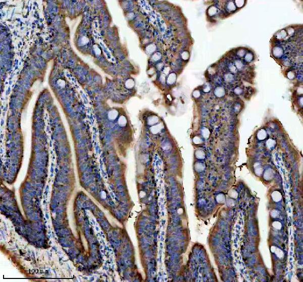 IHC analysis of ATPB/ATP5F1B using anti-ATPB/ATP5F1B antibody (AZA8WGC6)