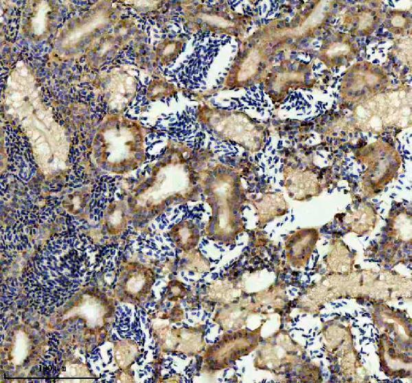 aza8wgc6 atp5f1b primary antibodies ihc testing 4