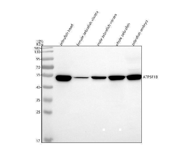  Western blot analysis of ATPB/ATP5F1B using anti-ATPB/ATP5F1B antibody (AZA8WGC6)
