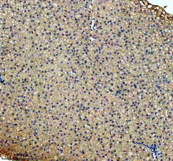  IHC analysis of CBS using anti-CBS antibody (AZA9JT04)