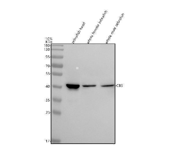  Western blot analysis of CBS using anti-CBS antibody (AZA9JT04)