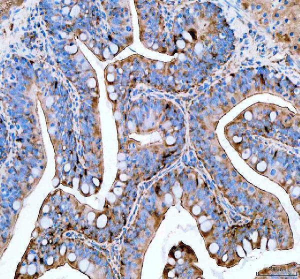  IHC analysis of PSMC4 using anti-PSMC4 antibody (AZB0R1D0)