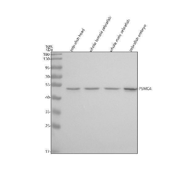  Western blot analysis of PSMC4 using anti-PSMC4 antibody (AZB0R1D0)