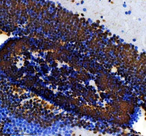 IHC analysis of FOXE3 using anti-FOXE3 antibody (AZB0UXI3)