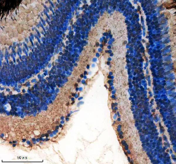 IHC analysis of FOXE3 using anti-FOXE3 antibody (AZB0UXI3)