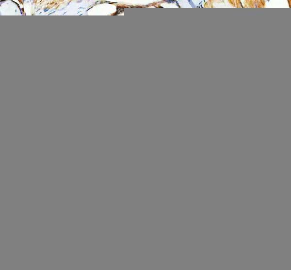 azb0uxs0 hmox1a primary antibodies ihc testing 2