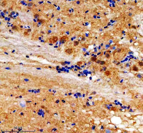 IHC analysis of MC4R using anti-MC4R antibody (AZB0V1P1)