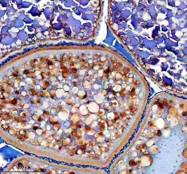 IHC analysis of MC4R using anti-MC4R antibody (AZB0V1P1)