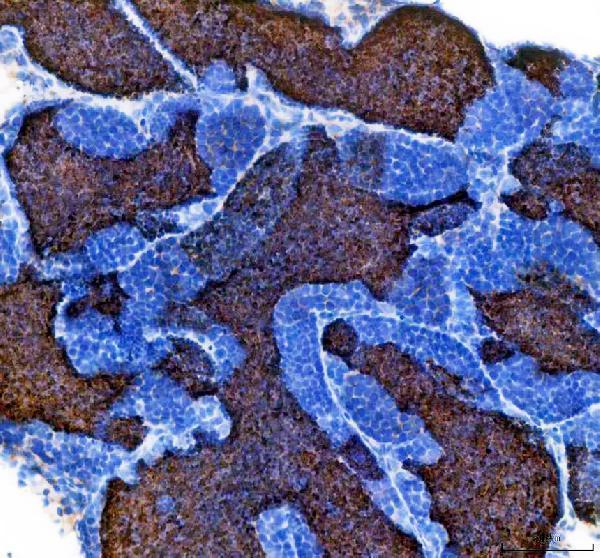 azb0z6g1 igf3 primary antibodies ihc testing 1