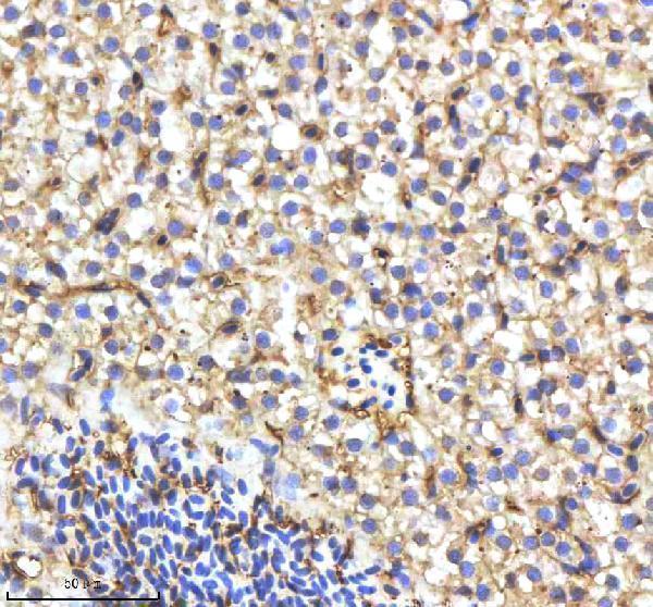 azb3dh80 cyp17a1 primary antibodies ihc testing 1
