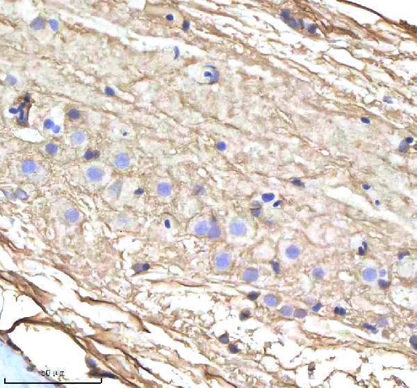 azb3dh80 cyp17a1 primary antibodies ihc testing 2
