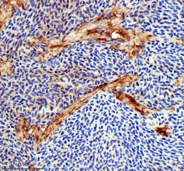 IHC analysis of FLT1 using anti-FLT1 antibody (AZB3DKP1)