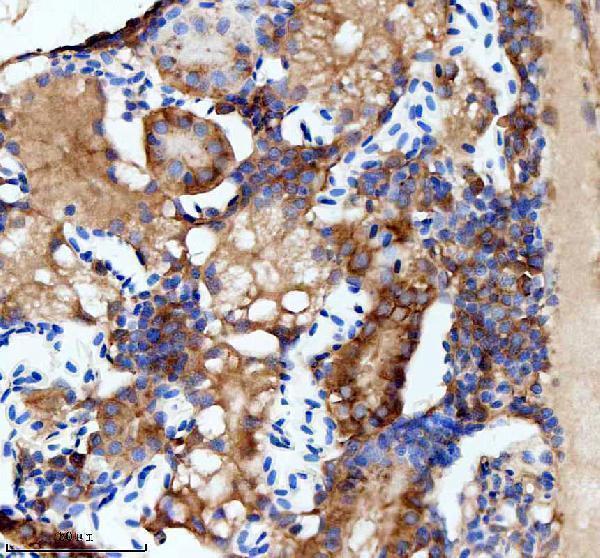 IHC analysis of FLT1 using anti-FLT1 antibody (AZB3DKP1)