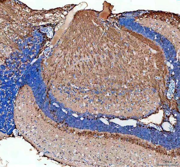 azb3dkp1 flt1 primary antibodies ihc testing 3