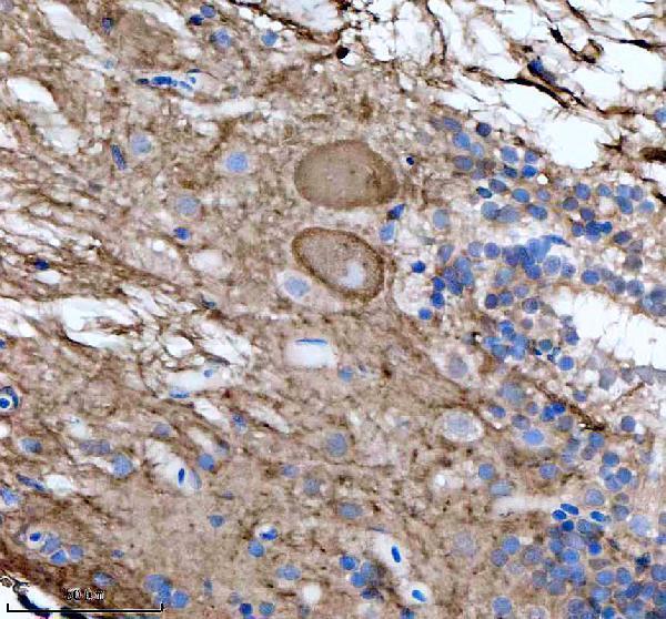 azb3dkp1 flt1 primary antibodies ihc testing 4