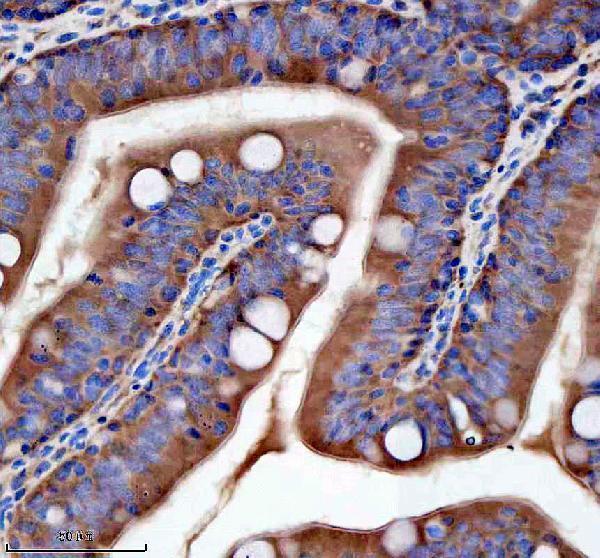 azb3dkp1 flt1 primary antibodies ihc testing 5